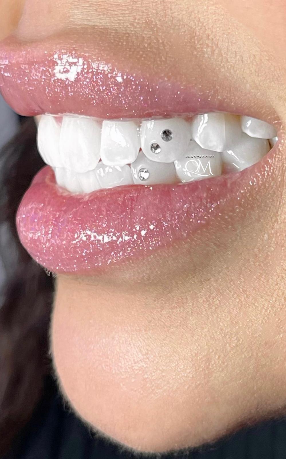 Macro tooth gem photography