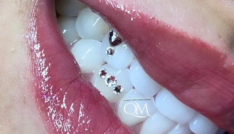 Diamond and crystal tooth gems arrangement