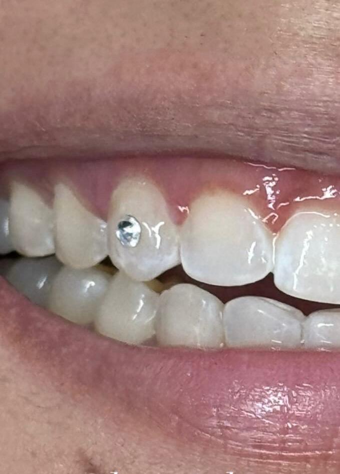 Subtle single tooth gem