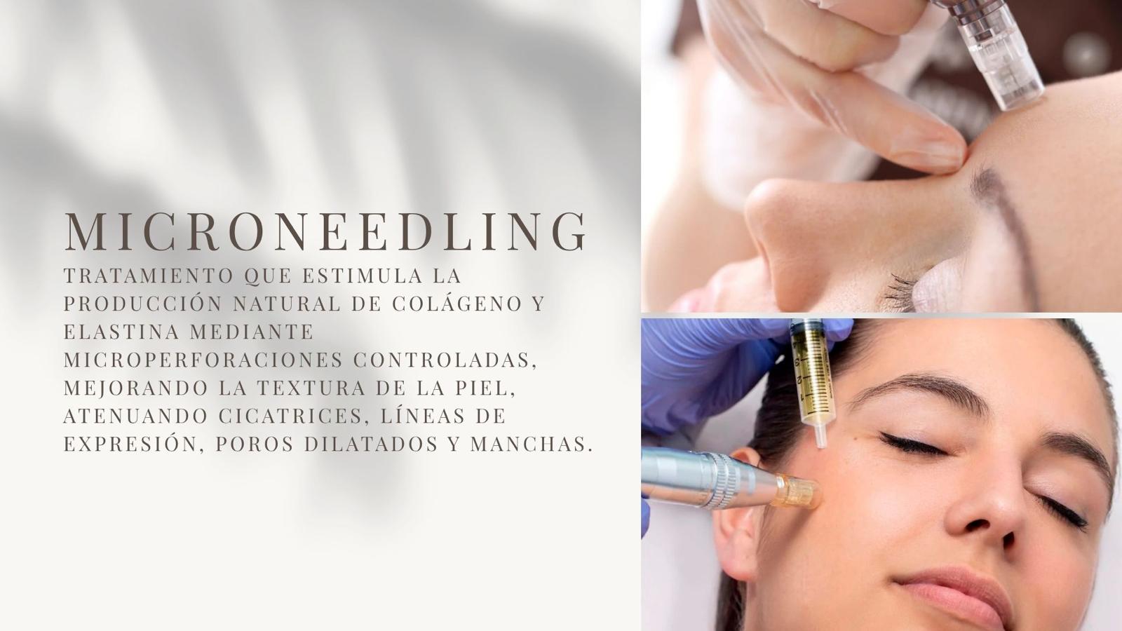 Dermapen: qué es y cómo funciona este tratamiento facial