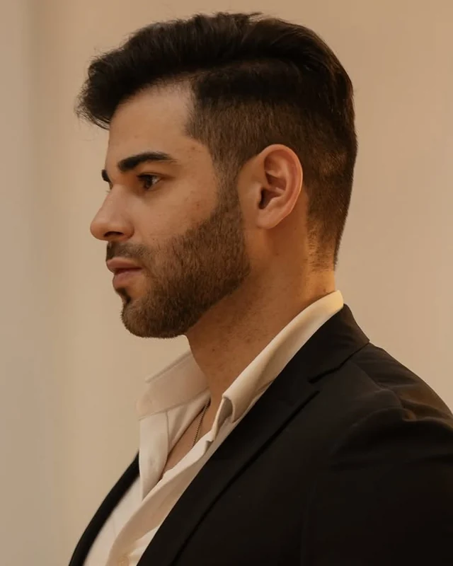 Antes e depois de projeto de visagismo masculino — Linha Frontal & Mandíbula, antes