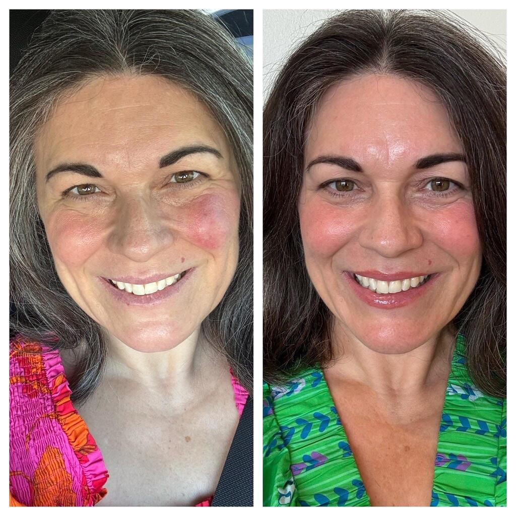 MagniGlow 1 month transformation 3