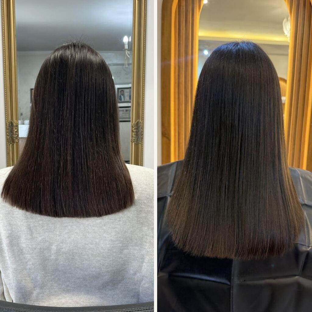 MagniGlow 6 months transformation result