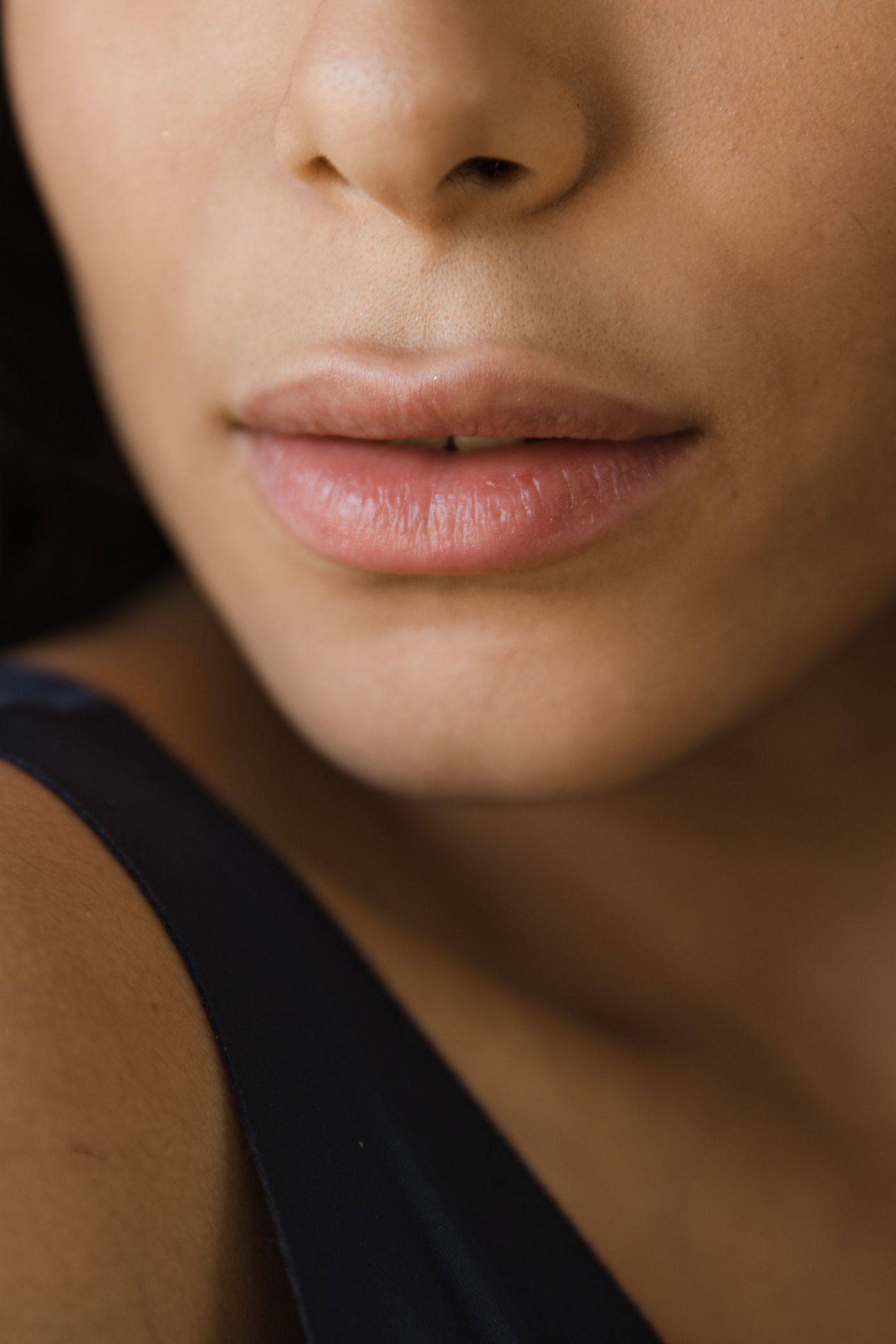 Editorial close-up of lips and the lower face, illustrative of a Filler Dissolving consultation focus