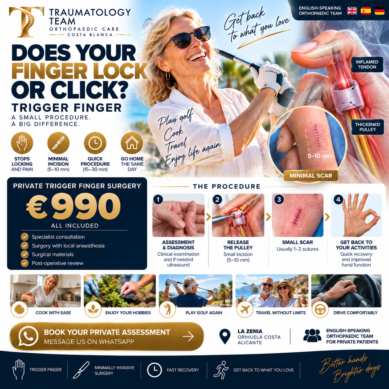 Private trigger finger surgery in Costa Blanca – Traumatology Team