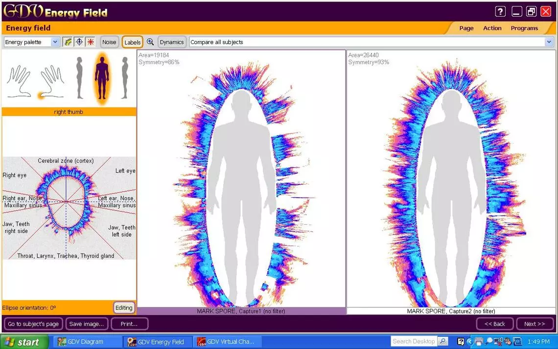 GDV Biofield Aura Imaging