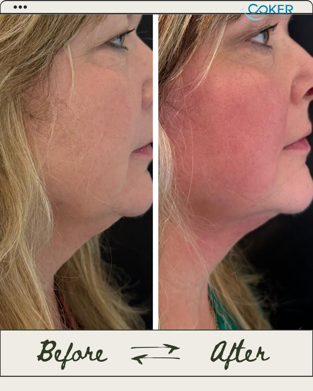 Obagi medical-grade skincare at Coker Dentistry in Florence, Alabama