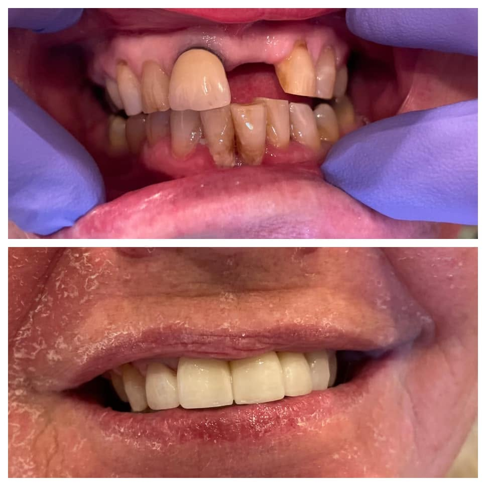 General and restorative dentistry at Coker Dentistry in Florence, Alabama