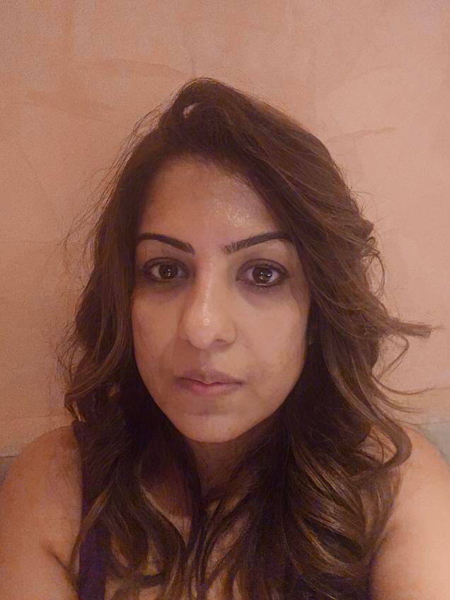 Pooja D. before