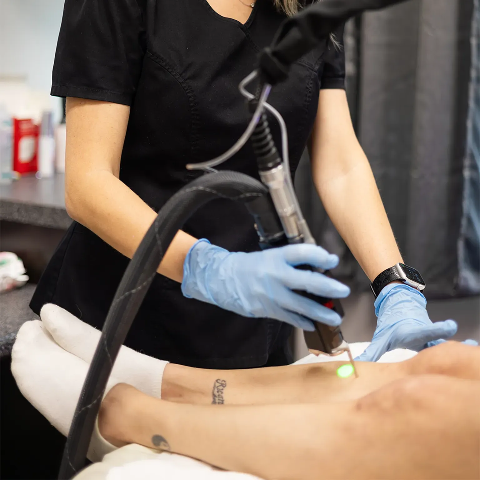 Laser Treatments