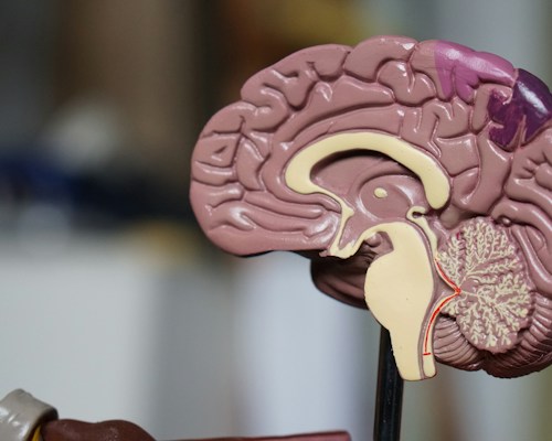Neurological Mysteries