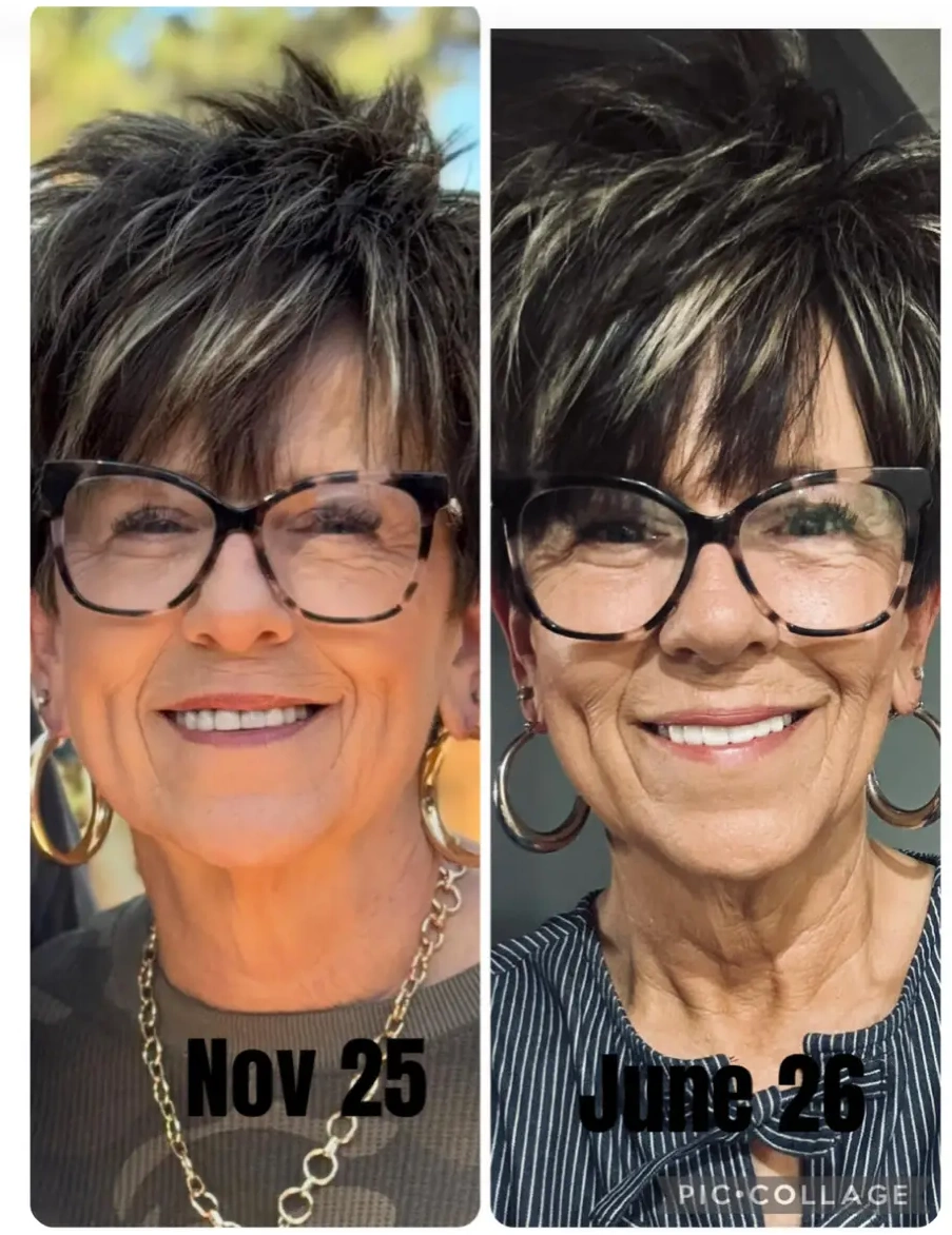 Carol S. Nov 25 to June 26 side-by-side transformation with glasses and smile