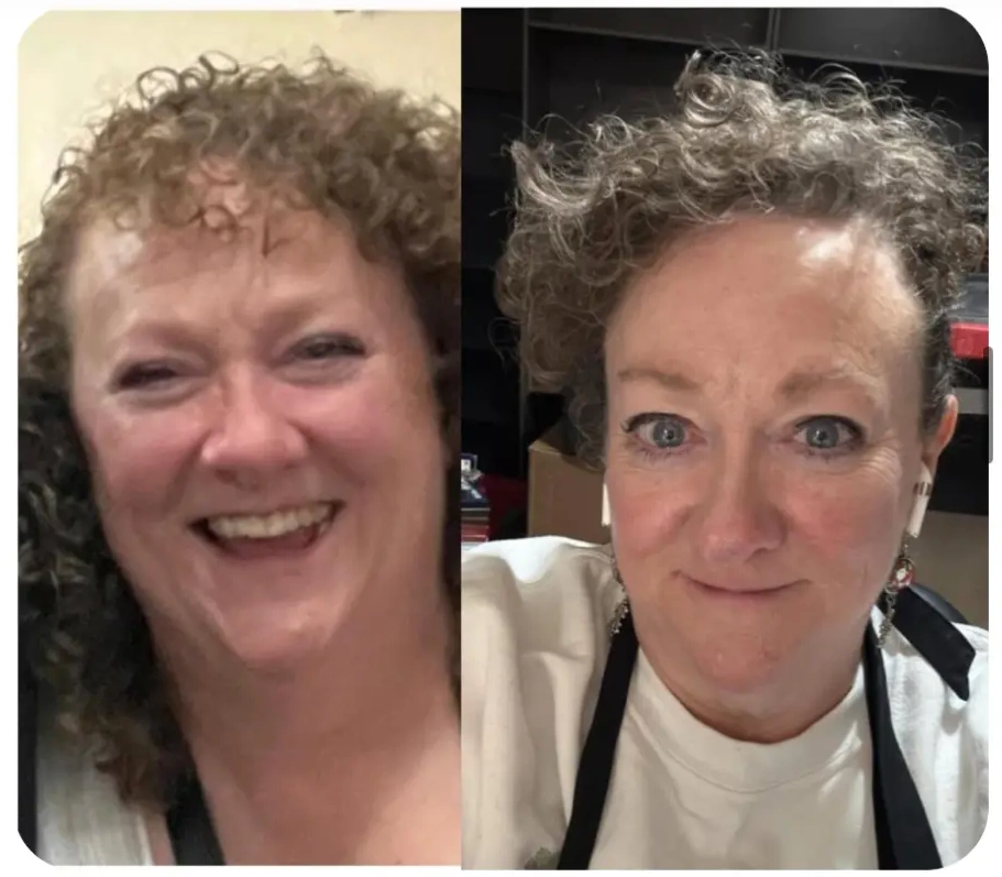 Side-by-side portrait showing 23 lbs lost, facial slimming, and inflammation relief