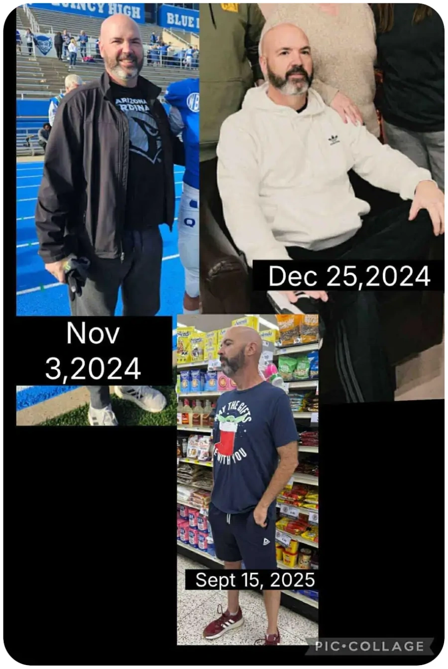 Bill's dramatic transformation side-by-side progress photo across Nov 2024 to Sept 2025