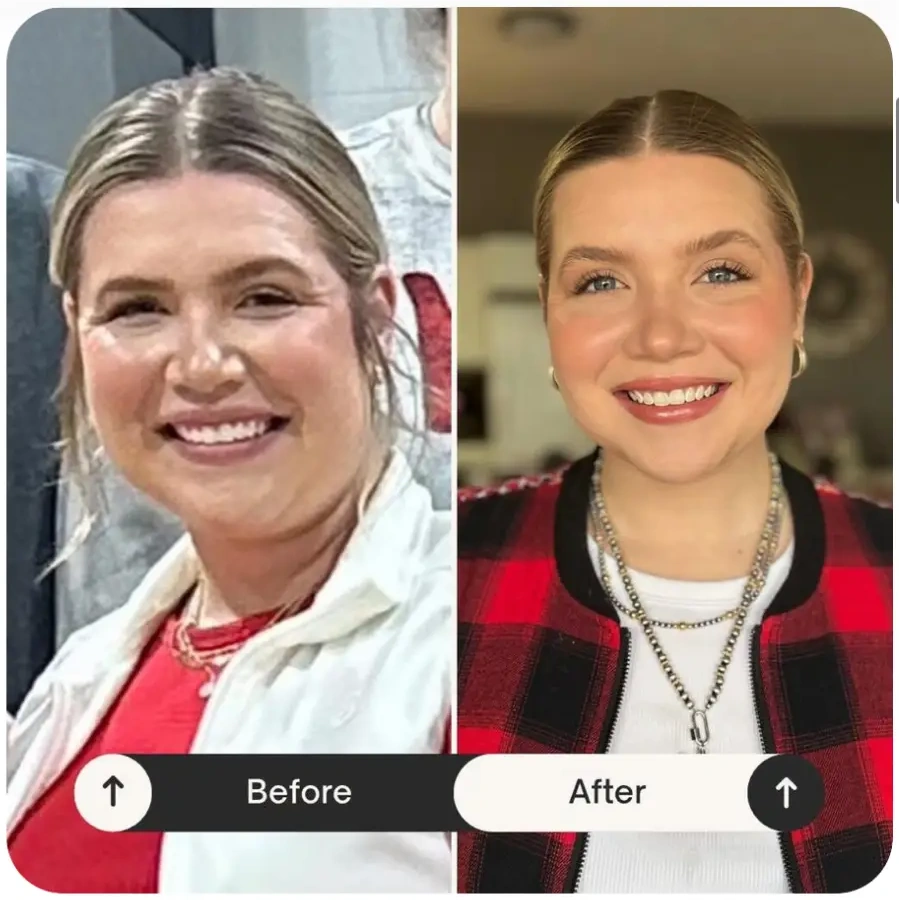 Gracie's before and after progress collage showing renewed mobility