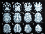 Georgia West Imaging MRI Grid