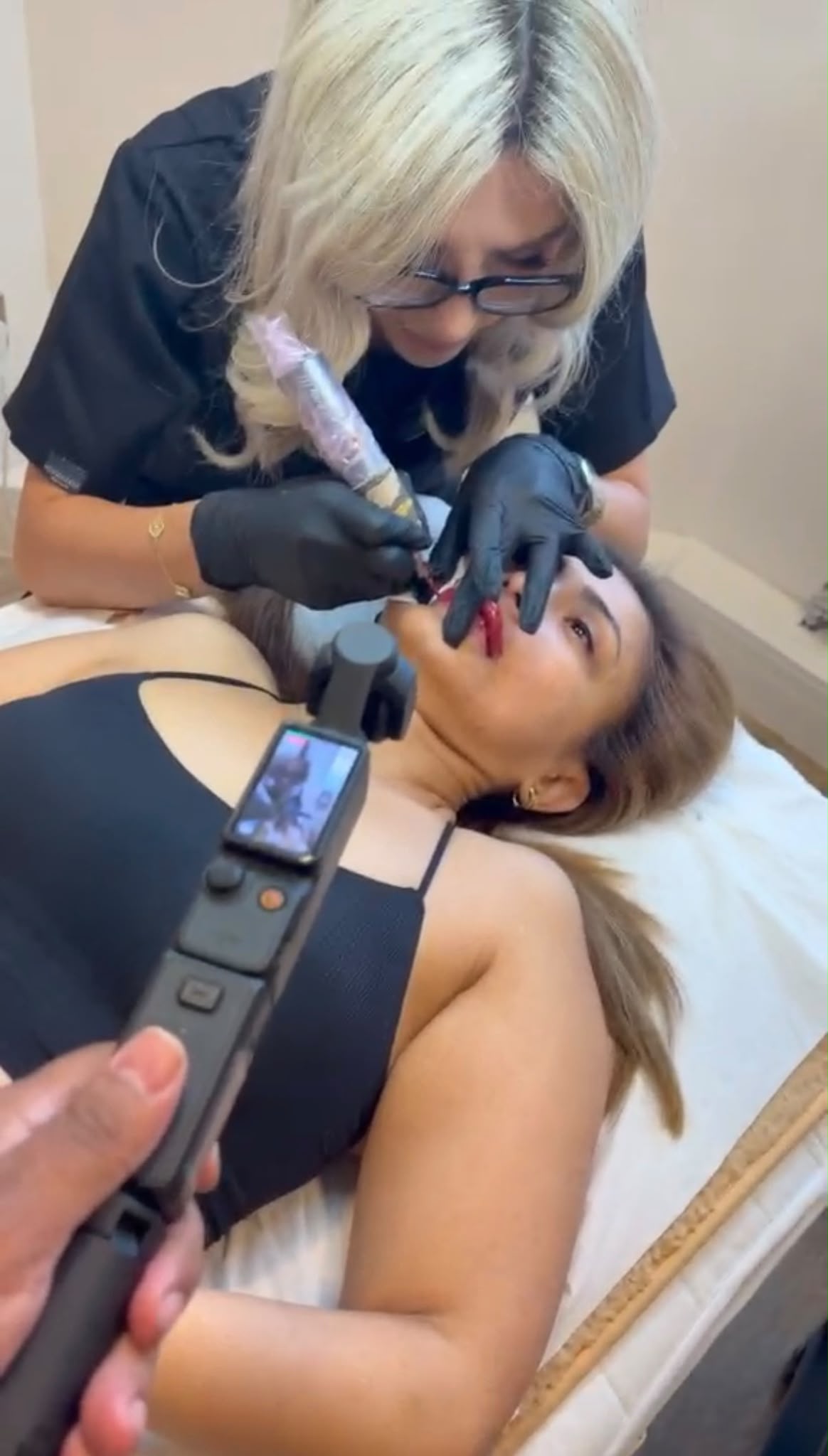 ignite webs In-Clinic Content Shoot - Close-up Lip Treatment Filming