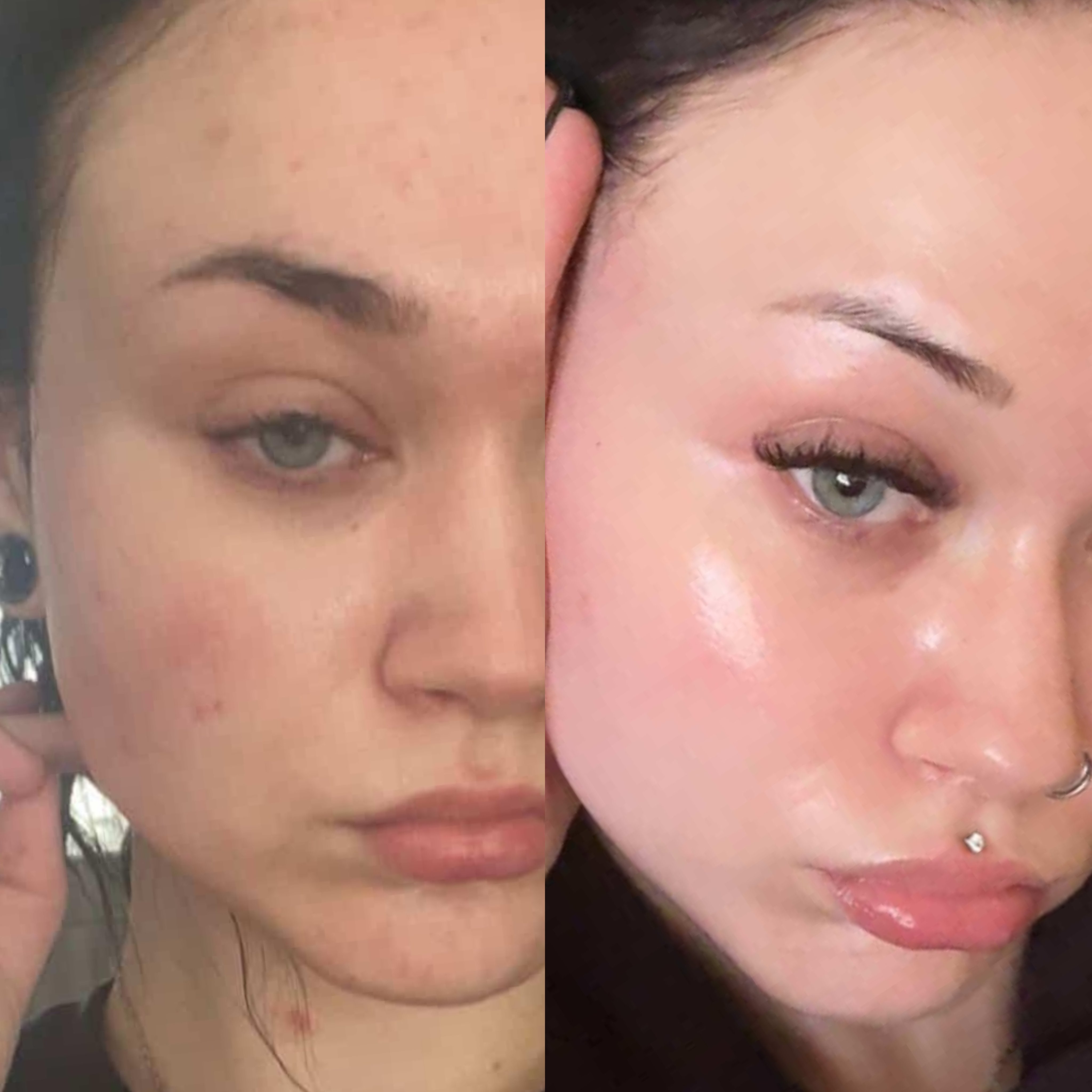 Skin Barrier Glow & Tone Transformation — client before and after results at Luxe Panda Beauty Edmonton