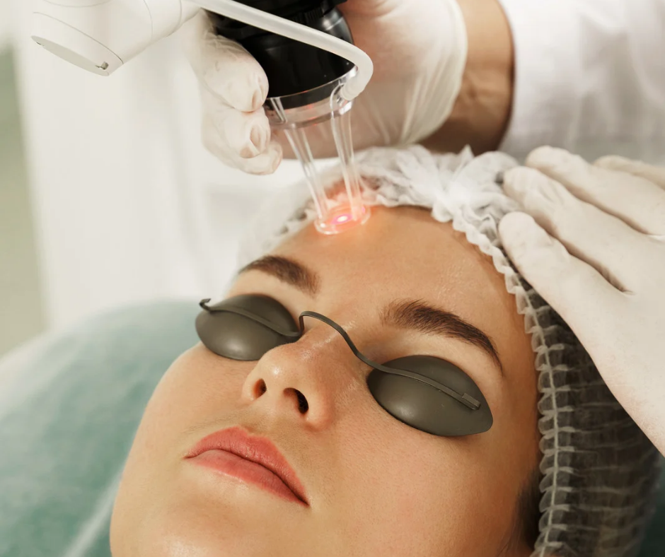 Laser Skin Rejuvenation
