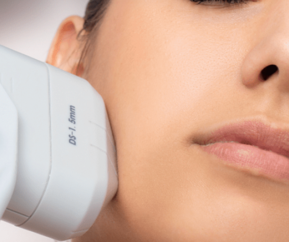 HIFU Skin Tightening and Collagen Stimulation at Opulent Skin Clinic