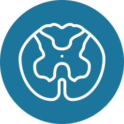 Illustration of degenerative disc disease