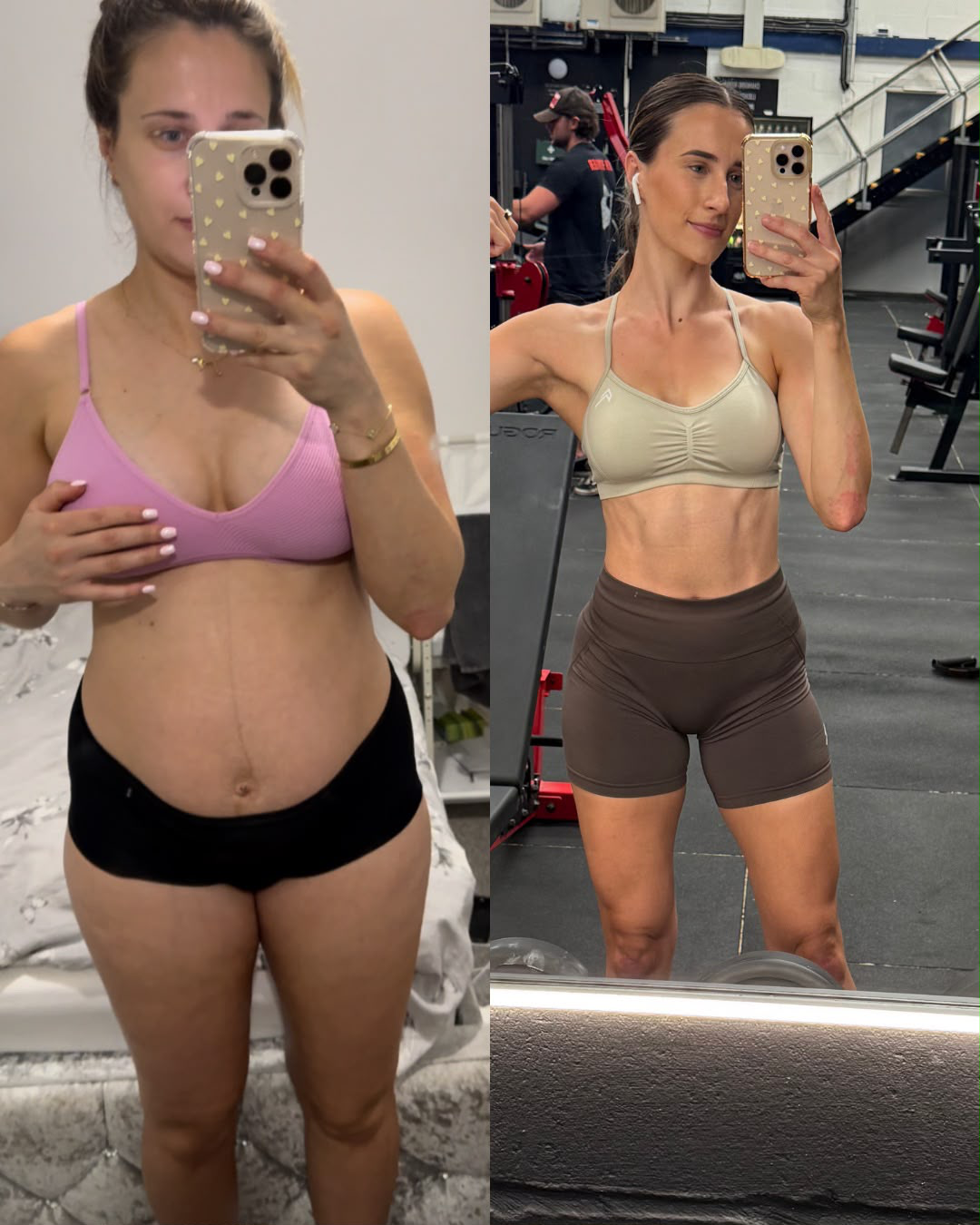 ALINE client mum transformation