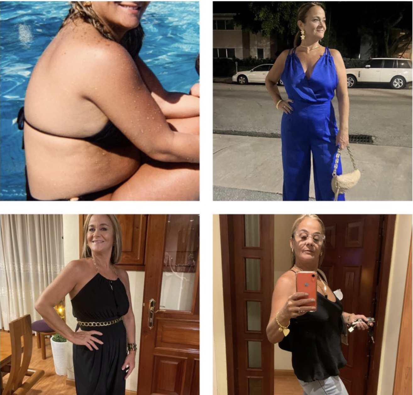 Evolución y proceso de paciente en Vizage Aesthetic Center