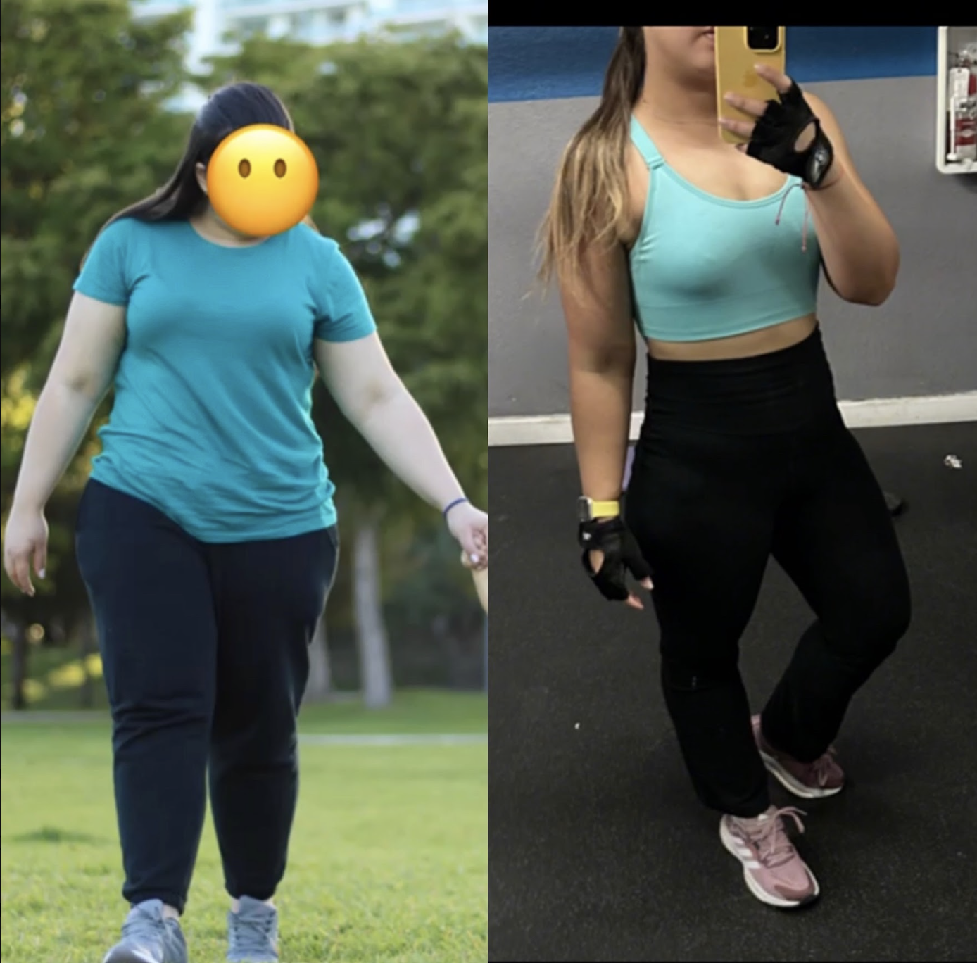 Caso real de transformación antes y después en Vizage Aesthetic Center