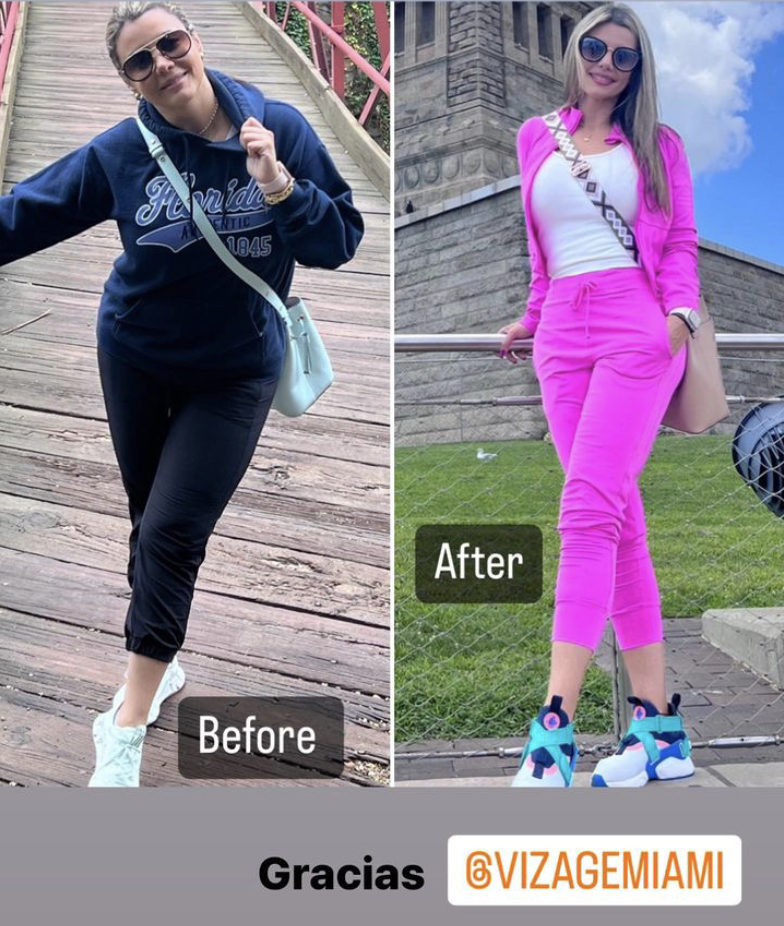 Caso real de transformación VIZAGE CHANGE 40+™