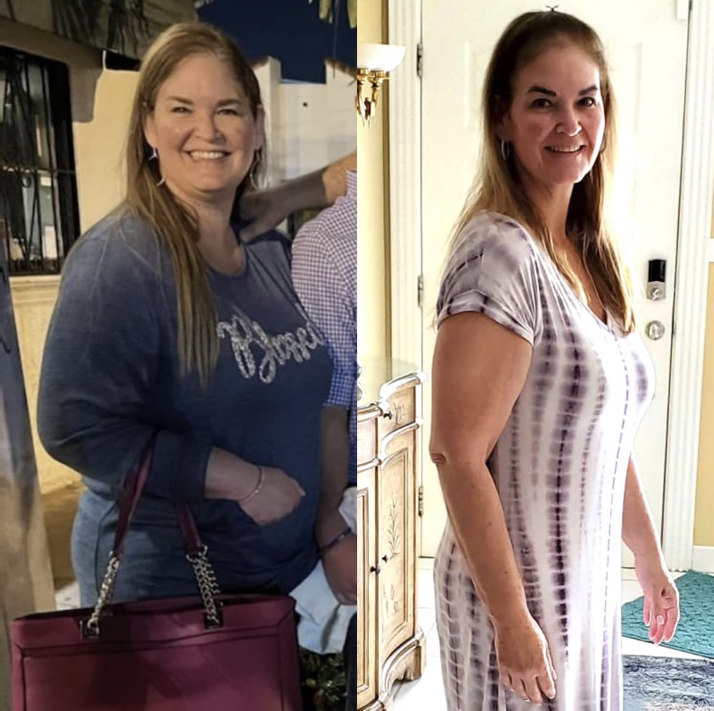 Transformación corporal y definición en Vizage Aesthetic Center