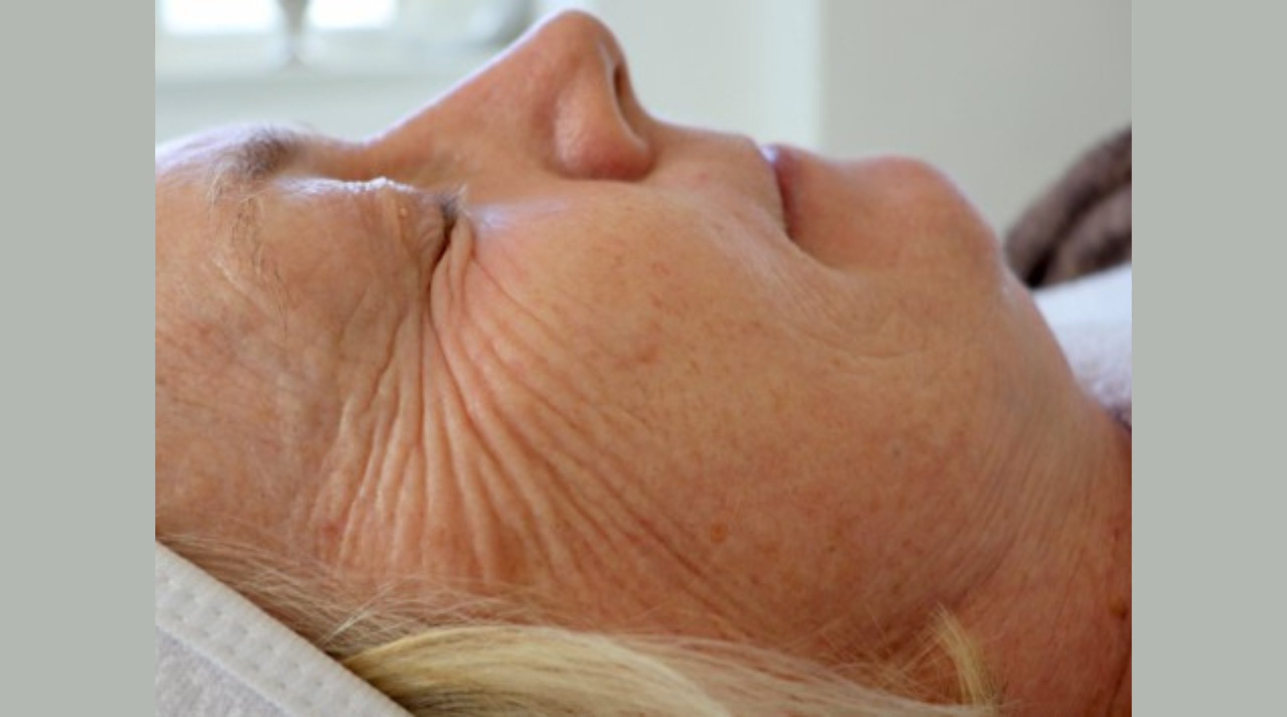 JetPeel clinical case before