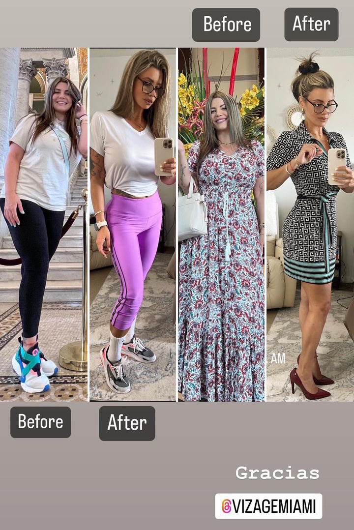 Caso real de transformación en Vizage Aesthetic Center