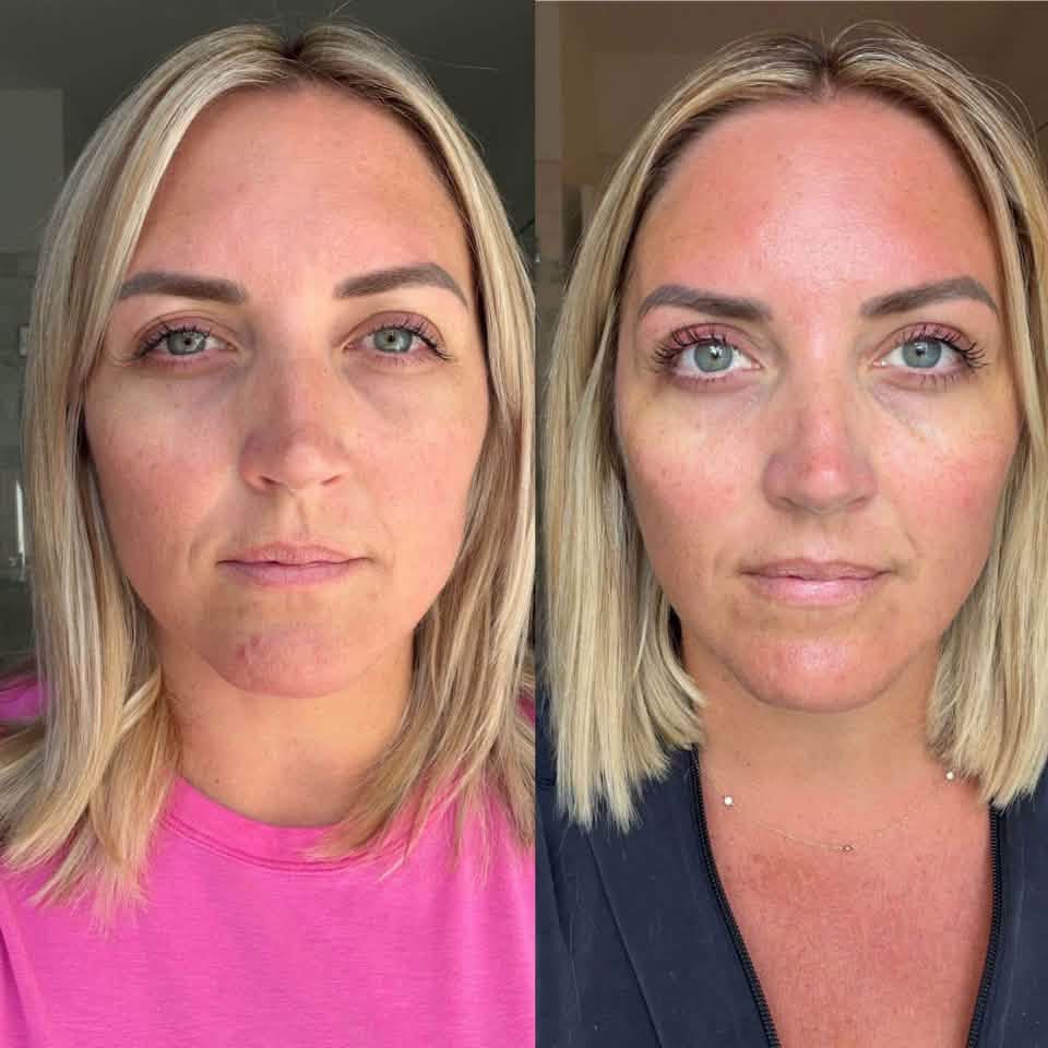Overall Complexion Luminosity & Tear Trough Tone