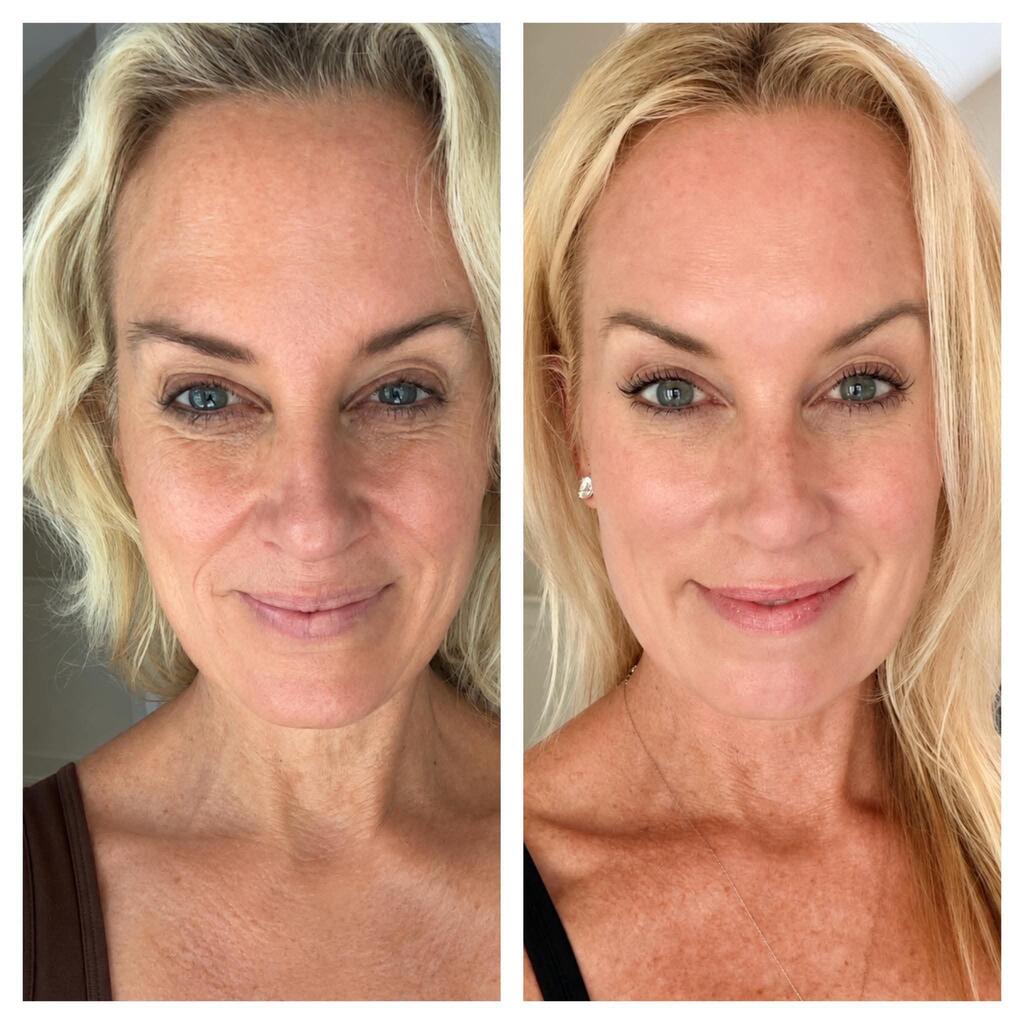 Décolleté & Facial Firmness Restoration