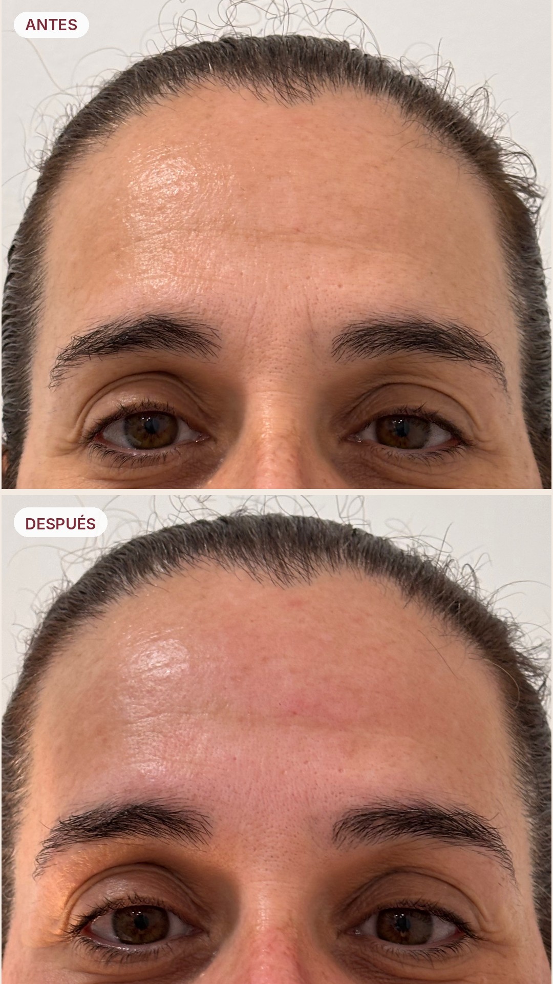 Resultado antes y después 2 - Revital 360