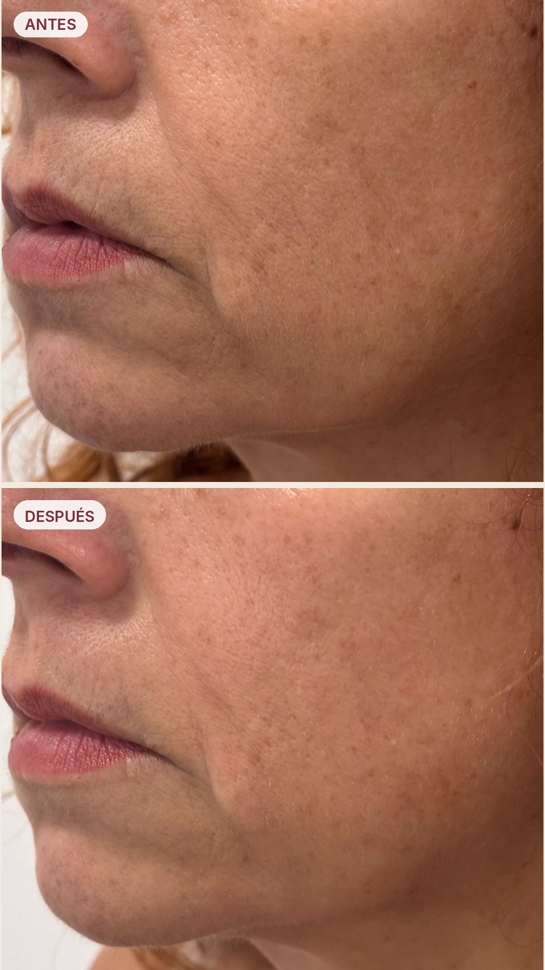 Resultado antes y después 4 - Revital 360