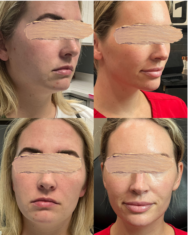 Facial Balancing