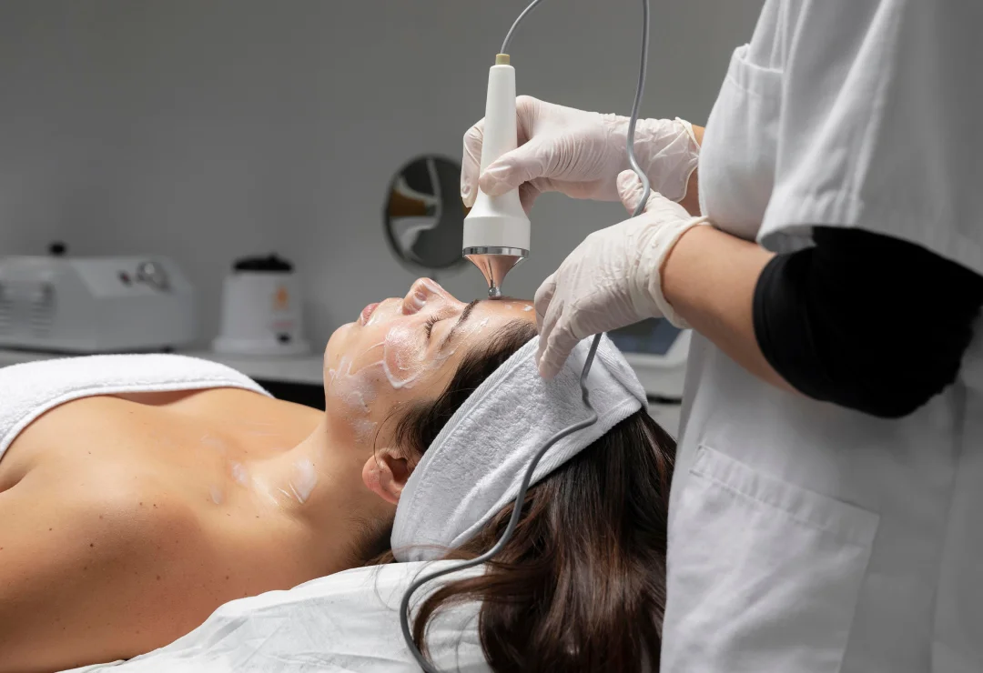 Microneedling treatment at Renew U Aesthetics & Wellness in Apple Valley, MN