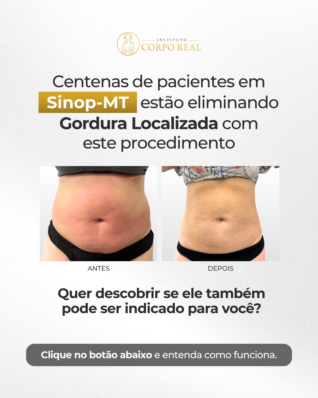 Anúncio Gordura Localizada