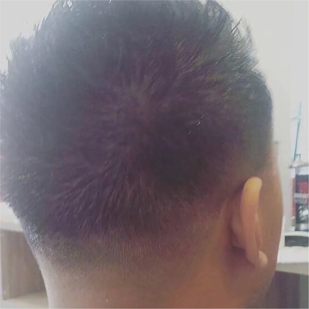 Crown Swirl & Precision Neck Taper by barber at Spartan Baracks in East York Toronto