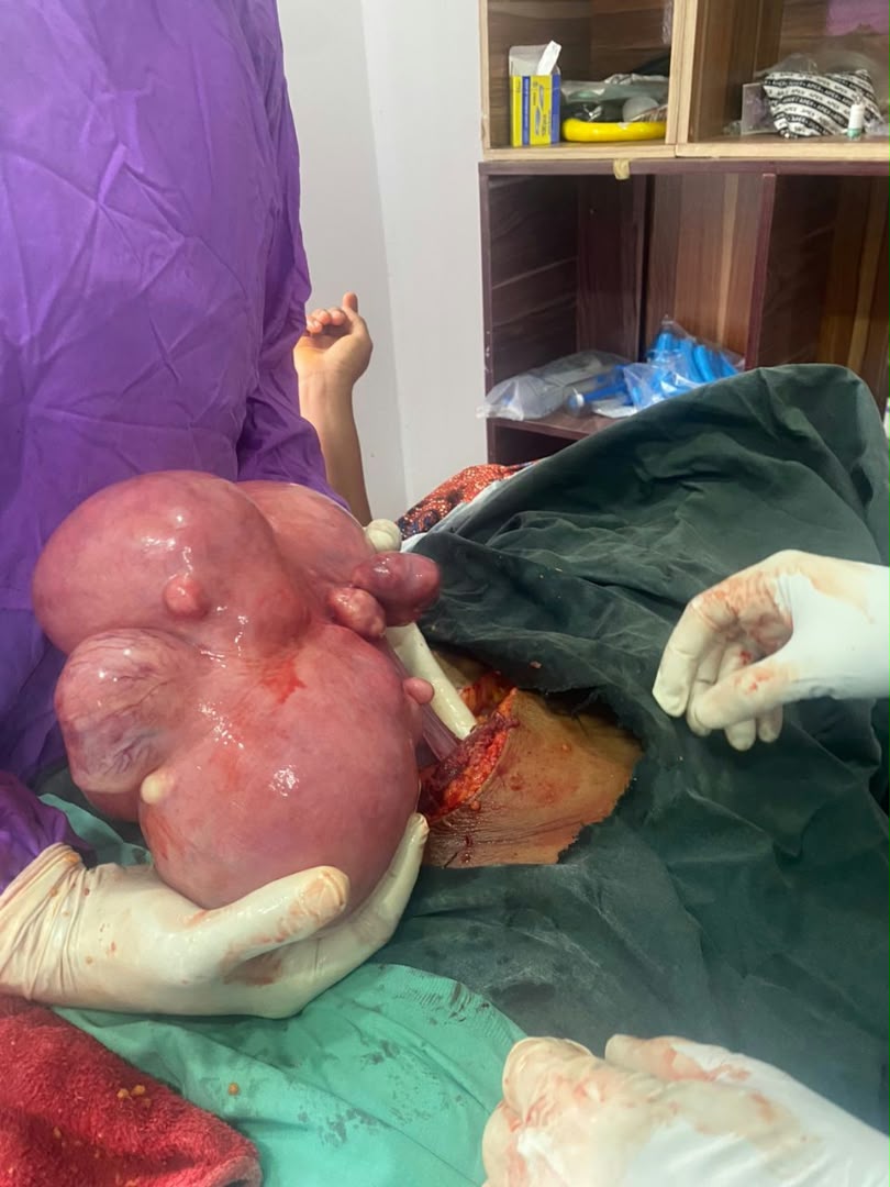 Clinical case photograph: Surgical Case 3