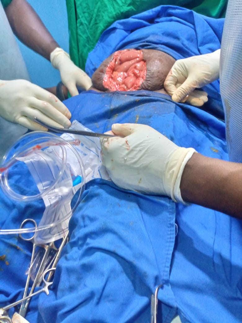 Clinical case photograph: Surgical Case 11