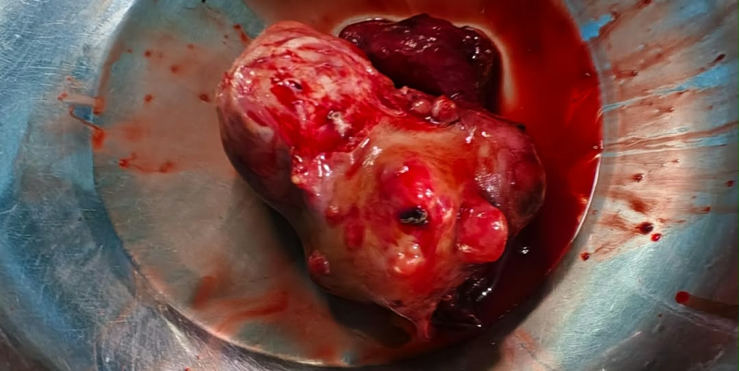 Clinical case photograph: Surgical Case 6