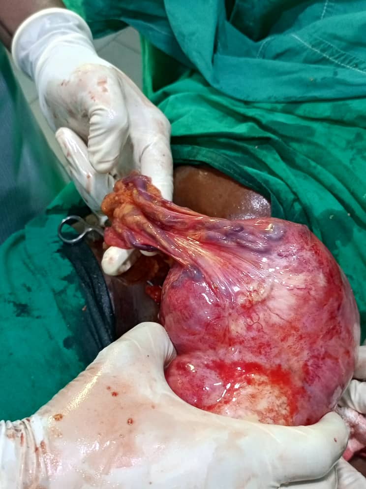 Clinical case photograph: Surgical Case 8