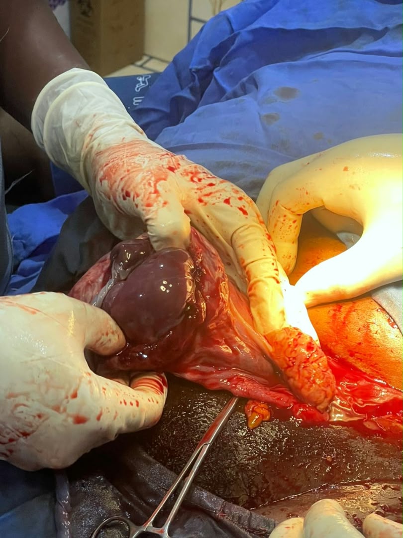 Clinical case photograph: Surgical Case 5