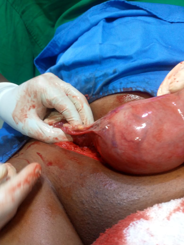 Clinical case photograph: Surgical Case 10
