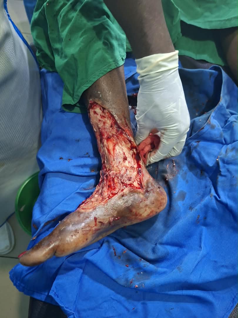 Clinical case photograph: Surgical Case 12