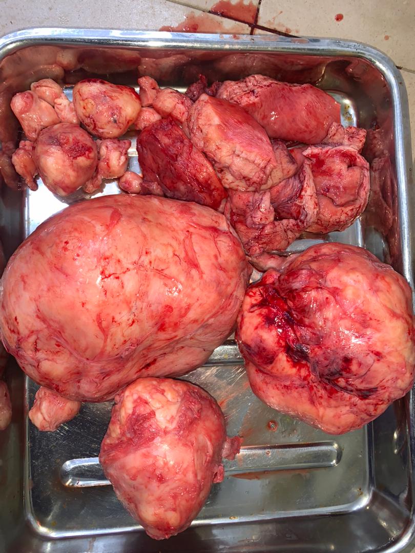 Clinical case photograph: Surgical Case 13