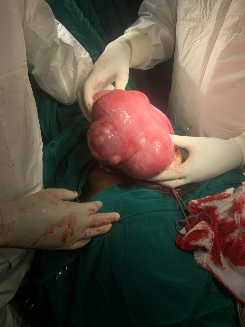 Clinical case photograph: Surgical Case 2