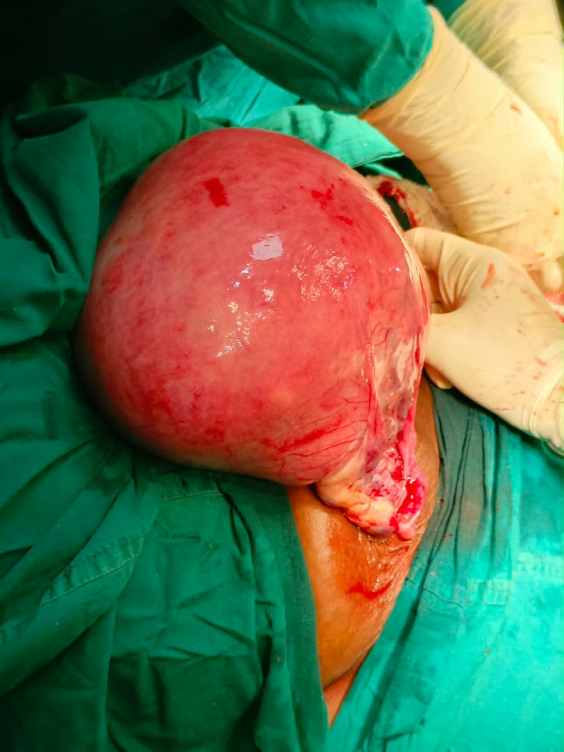 Clinical case photograph: Surgical Case 9